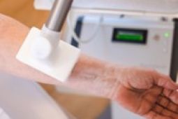 Trápí Vás nehojící se rány? Studené plasma může pomoci